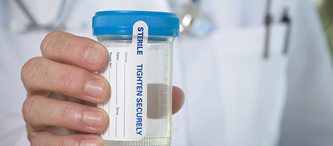 Physician holding drug test example