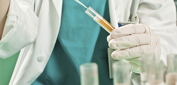 Lab technician wearing white coat and gloves testing urine