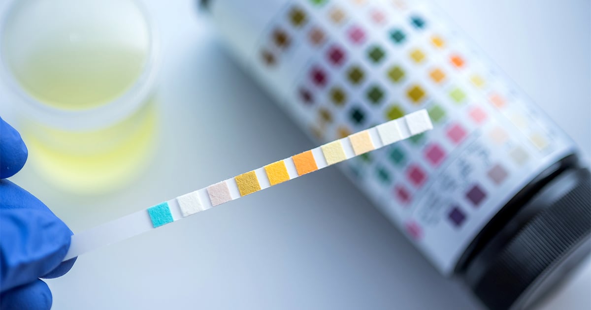 What Does a Drug Test Detect?